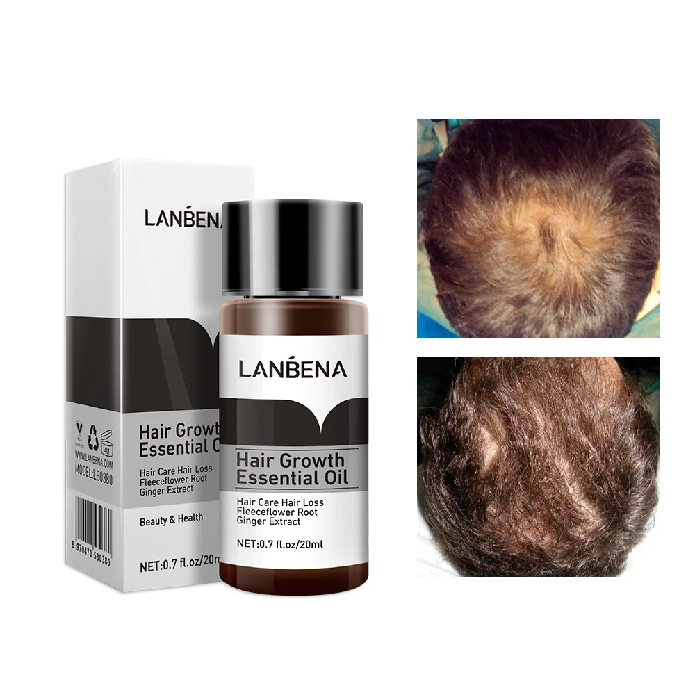 Hair Care Hair Growth Essential Oils Essence Original Authentic 100% Hair Loss Liquid Health Care Beauty Dense Hair Growth Serum
Hair Care Hair Growth Essential Oils Essence Original Authentic 100% Hair Loss Liquid Health Care Beauty Dense Hair Growth Serum