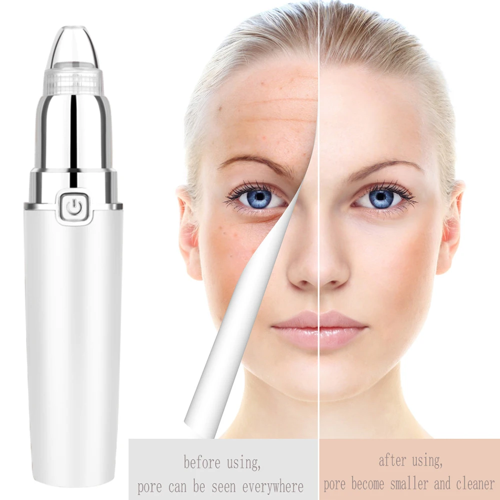 Acne Remover Point Noir Blackhead Vacuum Extractor Tool Black Spots Pore Suction Cleaner Skin Care Facial Pore Cleaner Machine 
Acne Remover Point Noir Blackhead Vacuum Extractor Tool Black Spots Pore Suction Cleaner Skin Care Facial Pore Cleaner Machine