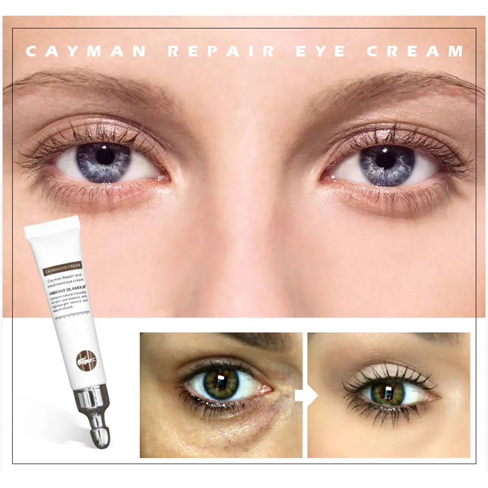 1pc Collagen Eye Cream Anti Wrinkle Remove Eye Bag Anti Puffiness Dark Circles Fat Granule Moisturizing health Beauty Eye Care
1pc Collagen Eye Cream Anti Wrinkle Remove Eye Bag Anti Puffiness Dark Circles Fat Granule Moisturizing health Beauty Eye Care