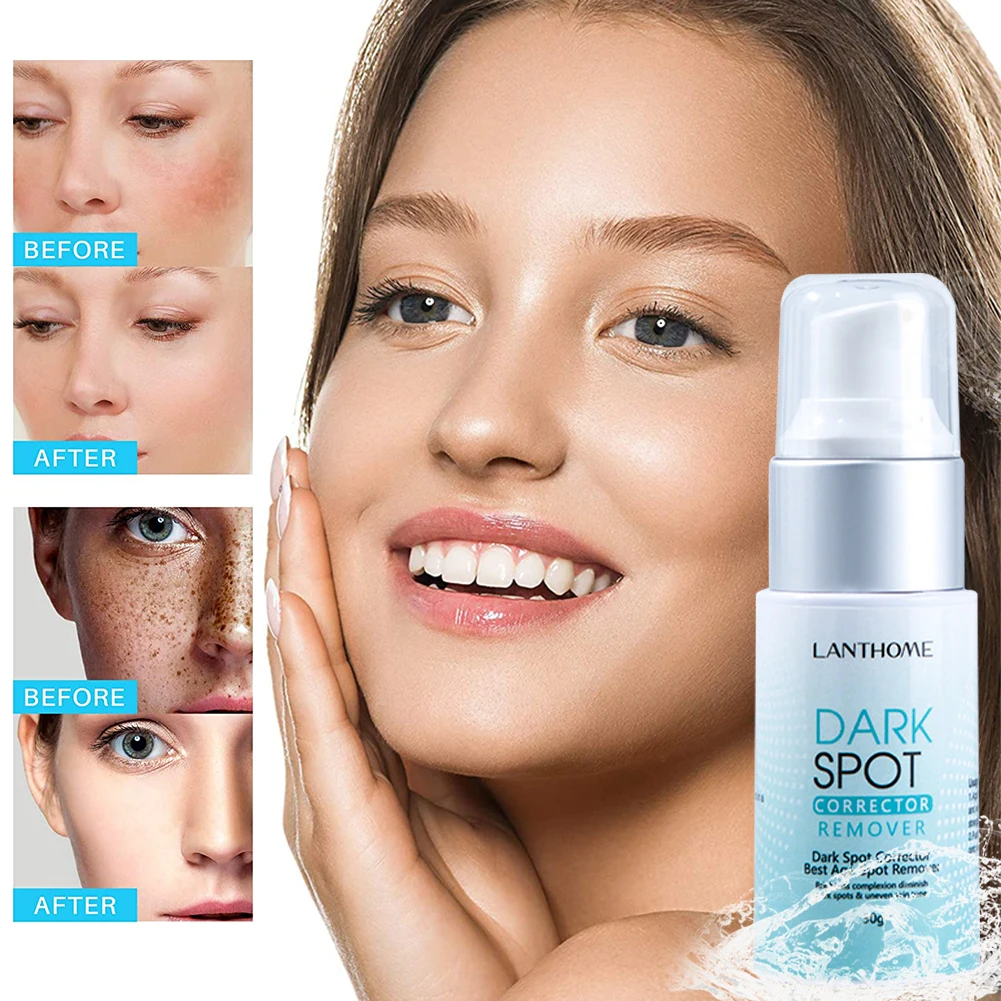 30g Dark Spot Remover Corrector Age Spot Freckle Removal Emulsion Whitening Moisturizing Anti-Aging Skin Repair Skin Care
30g Dark Spot Remover Corrector Age Spot Freckle Removal Emulsion Whitening Moisturizing Anti-Aging Skin Repair Skin Care
