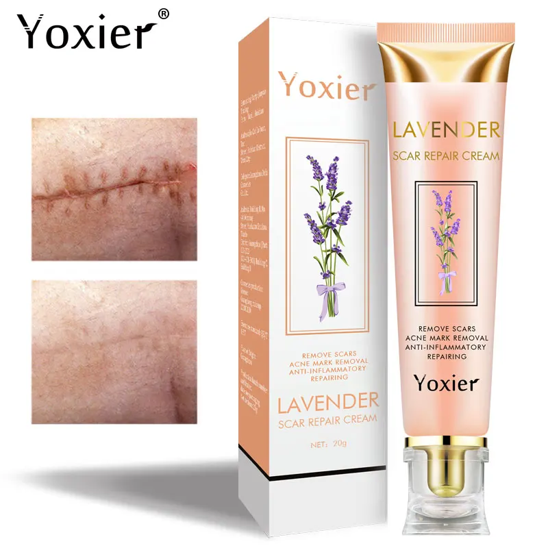 Lavender Scar Repair Cream Repairing Removing Burn Scars Promote Cell Regeneration Enhance Elasticity Cucumber Skin Care 20g
Lavender Scar Repair Cream Repairing Removing Burn Scars Promote Cell Regeneration Enhance Elasticity Cucumber Skin Care 20g