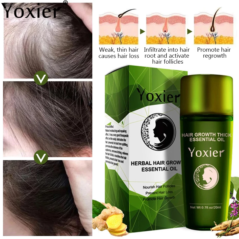 Herbal Hair Growth Essential Oil Germinal Hair Growth Serum Essence Oil Hair Loss Treatment Growth Hair For Men Women 20ml
Herbal Hair Growth Essential Oil Germinal Hair Growth Serum Essence Oil Hair Loss Treatment Growth Hair For Men Women 20ml