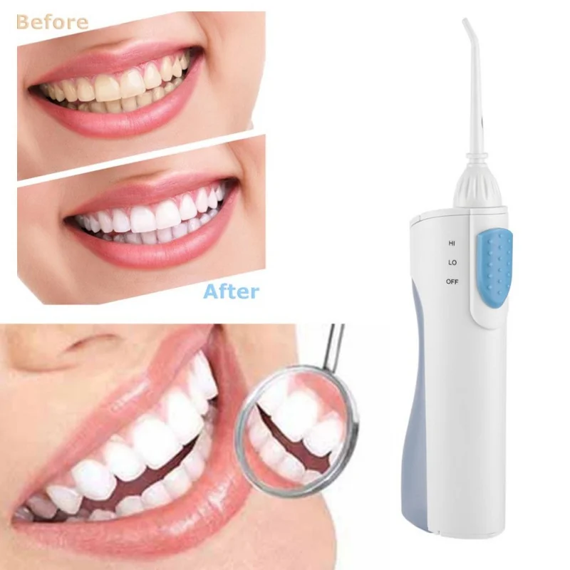 Oral Dental Irrigator Portable battery Irrigator Water Dental Flosser Travel Mouth Denture Cleaner
Oral Dental Irrigator Portable battery Irrigator Water Dental Flosser Travel Mouth Denture Cleaner