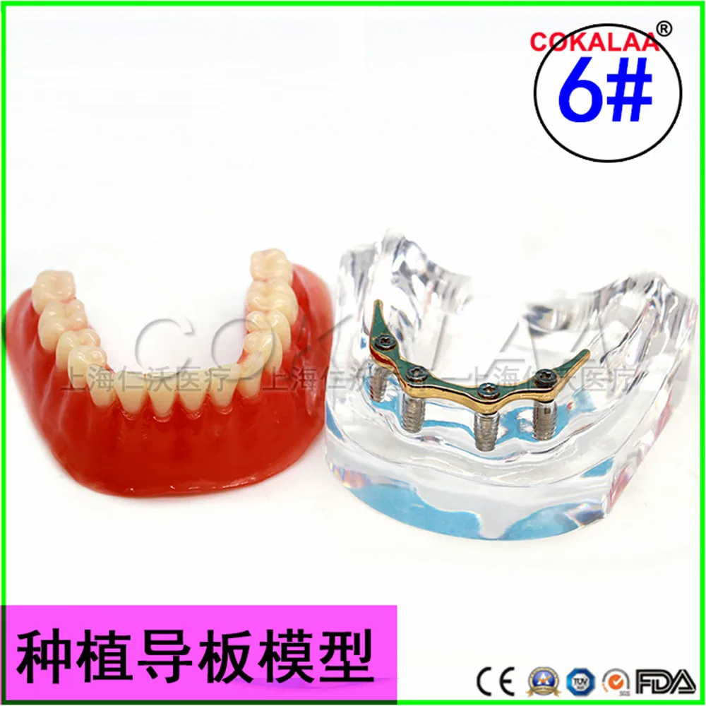 12 типов покрытия из смолы, модельные протезы для имплантации зубов, модель зубы
12 типов покрытия из смолы, модельные протезы для имплантации зубов, модель зубы