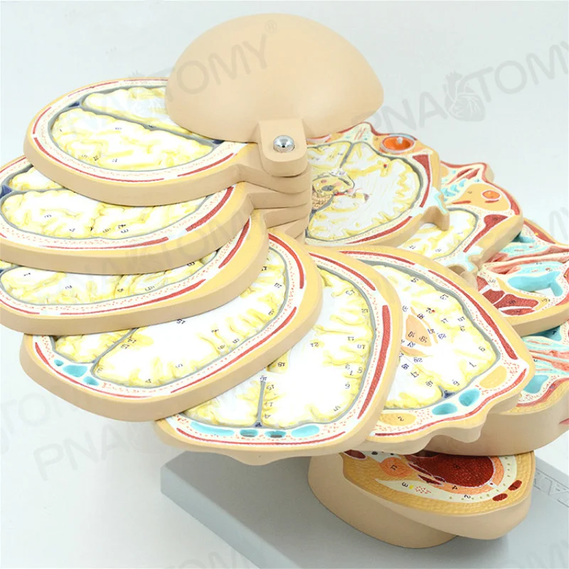 transverse 12 layer Brain section model ctmri brain model radiation magnetic resonance imaging teaching neurology 
transverse 12 layer Brain section model ctmri brain model radiation magnetic resonance imaging teaching neurology