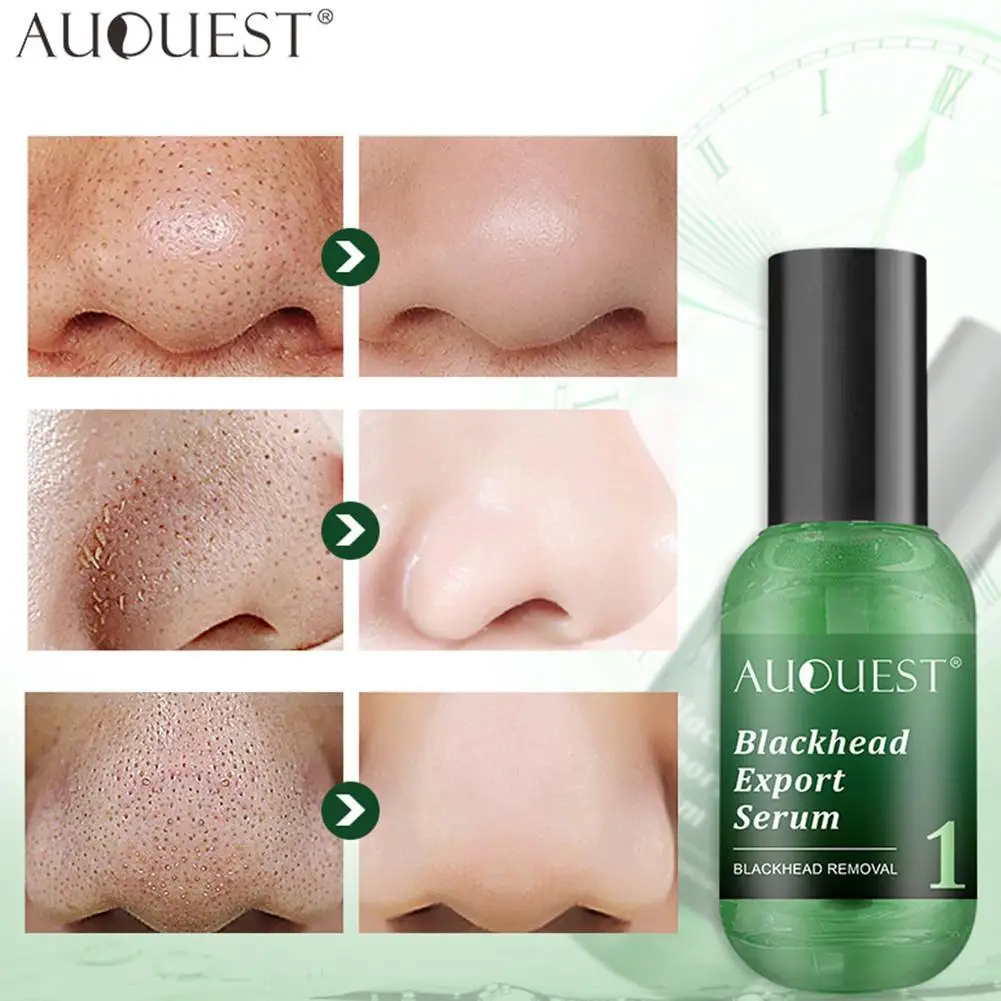 Face Serum Blackhead Removal Pore Shrinking Oil-Control Face Korean Cosmetics Whitening Care Moisturizing Skin M3H0
Face Serum Blackhead Removal Pore Shrinking Oil-Control Face Korean Cosmetics Whitening Care Moisturizing Skin M3H0
