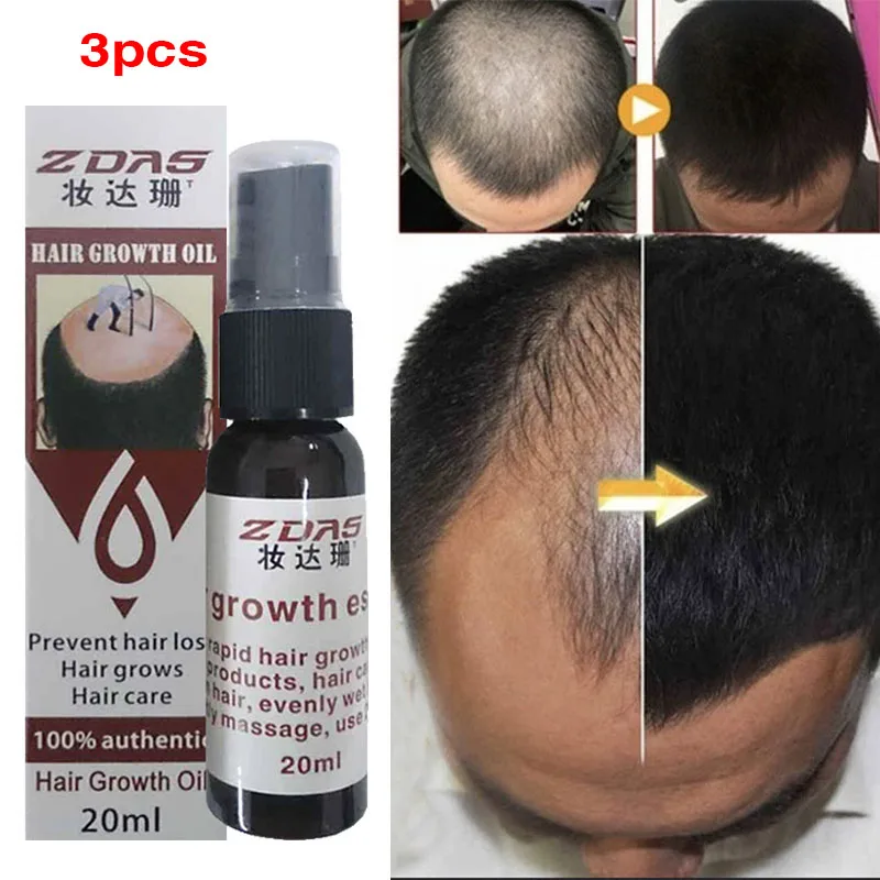 3pcs 20ml Fast Hair Growth Essence Oil Ginger Hair Growth Serum Nourishing Soften Treatment Hair Loss Repair Damaged Hair
3pcs 20ml Fast Hair Growth Essence Oil Ginger Hair Growth Serum Nourishing Soften Treatment Hair Loss Repair Damaged Hair
