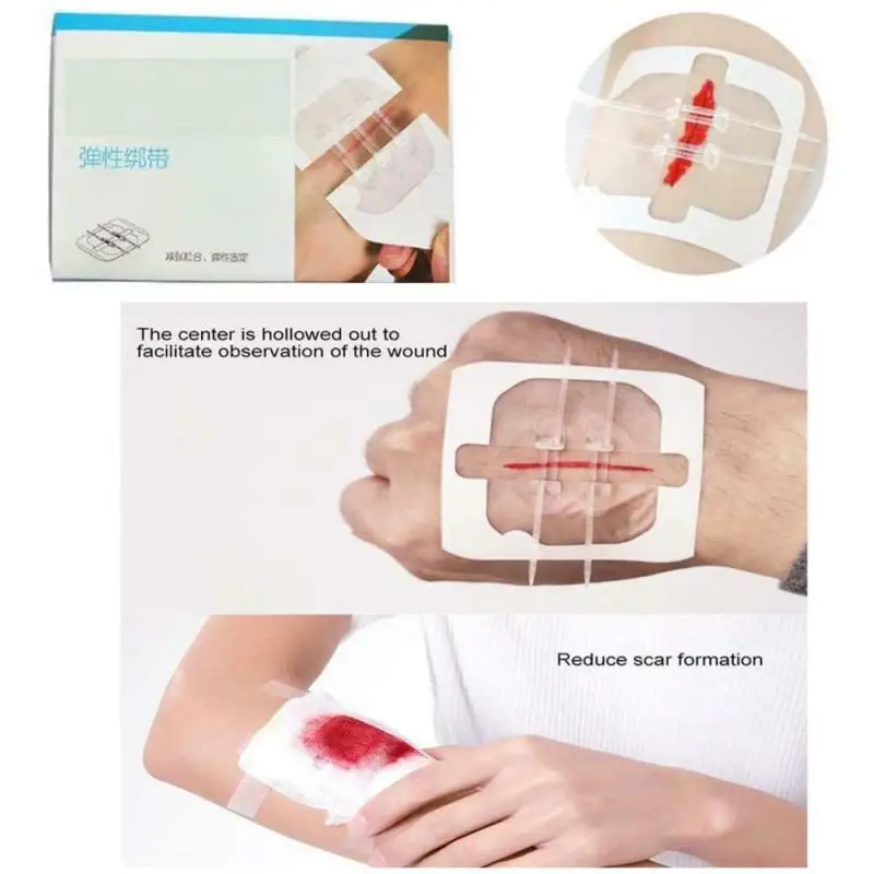 50pcs / Box Wound Paste First Aid Bandage Hemostasis Band-aid Plaster Bandage For All Types Of People
50pcs / Box Wound Paste First Aid Bandage Hemostasis Band-aid Plaster Bandage For All Types Of People