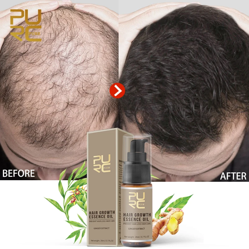 PURC Hair Growth Serum Oils Fast Hair Growth Products Hair & Scalp Treatments for Thinning Beauty Hair Care Men Women 20ml
PURC Hair Growth Serum Oils Fast Hair Growth Products Hair & Scalp Treatments for Thinning Beauty Hair Care Men Women 20ml