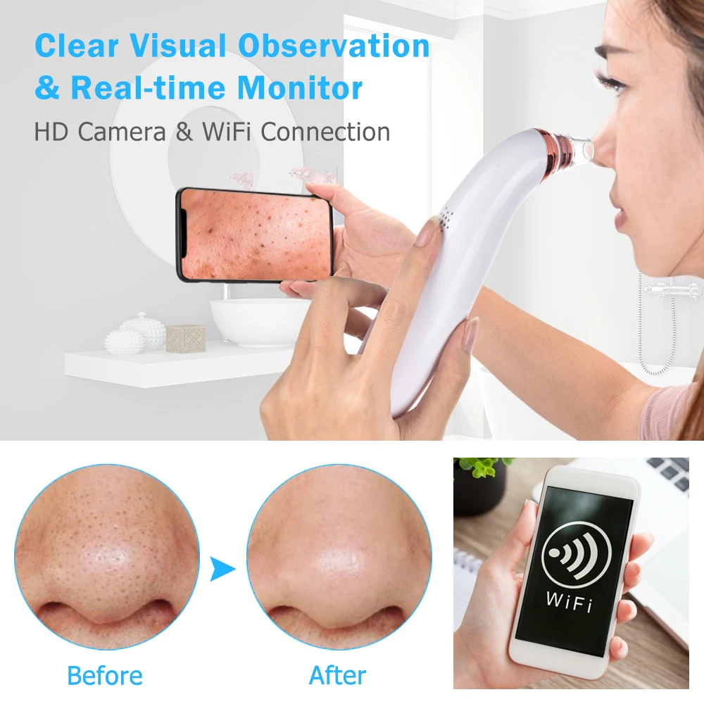 USB Rechargeable Visual Blackhead Remover Facial Pores Black Head Cleaner Vacuum Suction WIFI Microscope Camera Face Care Tool
USB Rechargeable Visual Blackhead Remover Facial Pores Black Head Cleaner Vacuum Suction WIFI Microscope Camera Face Care Tool