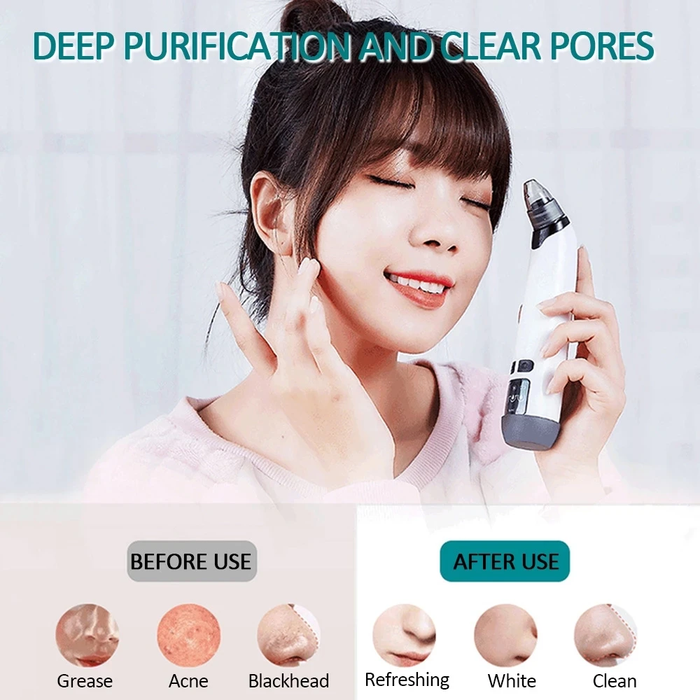 Heating Blackhead Remover Vacuum Electric Facial Suction Pore Cleaner Extractor Needles Acne Pimple Removal with Gift
Heating Blackhead Remover Vacuum Electric Facial Suction Pore Cleaner Extractor Needles Acne Pimple Removal with Gift