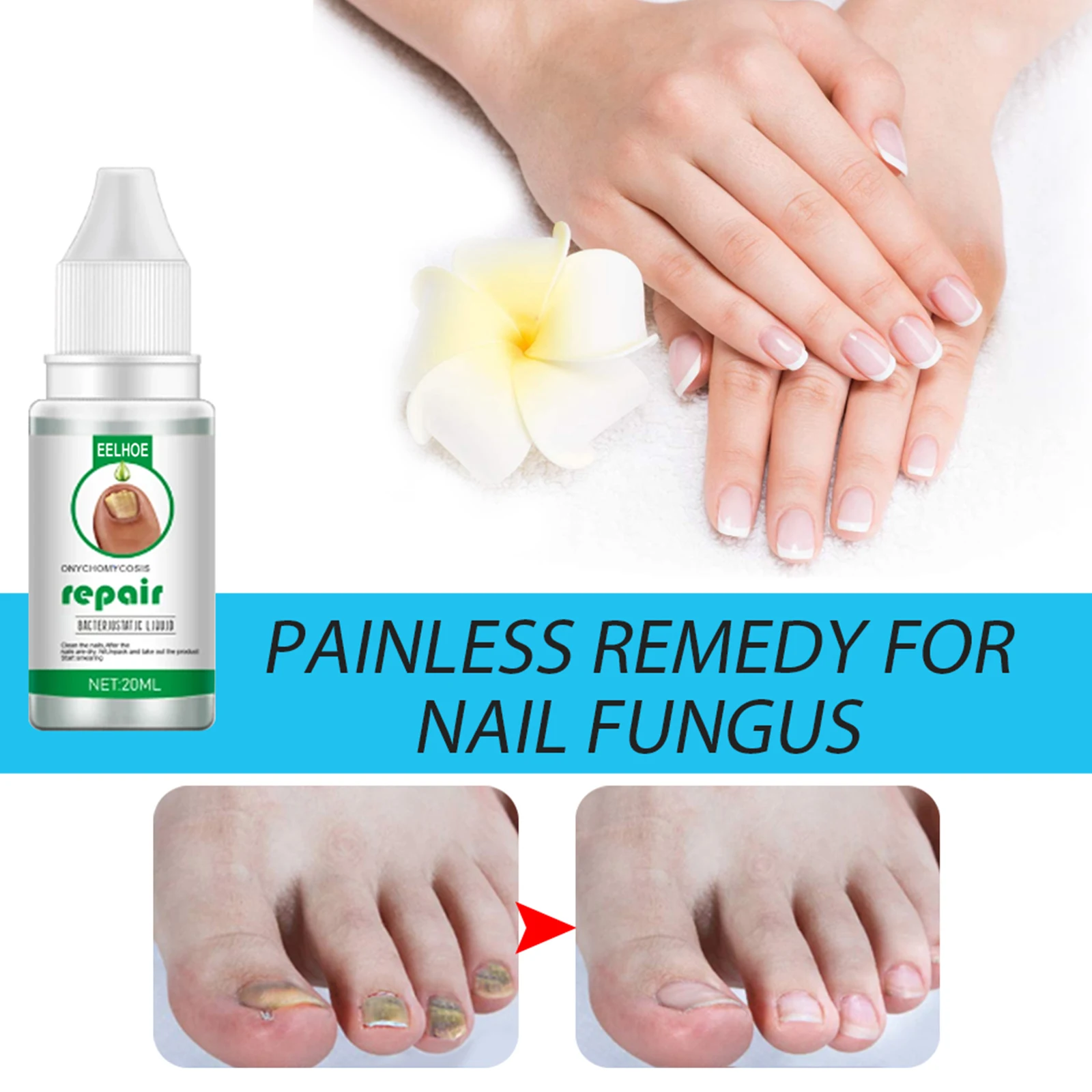 20ML Nail Fungus Treatment Feet Care Essence Fungal Nail Foot Toe Repair Removal Gel Anti Infection Paronychia Onychomycosi
20ML Nail Fungus Treatment Feet Care Essence Fungal Nail Foot Toe Repair Removal Gel Anti Infection Paronychia Onychomycosi
