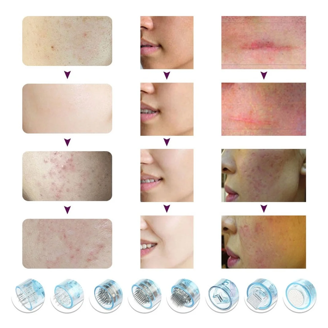 50PCS Dr. Pen Pin Cartridge Electric Derma Rolling Bayonet Cartridges 5D Nano X5 Needle Micro Skin Needling Tip Derma Stamp
50PCS Dr. Pen Pin Cartridge Electric Derma Rolling Bayonet Cartridges 5D Nano X5 Needle Micro Skin Needling Tip Derma Stamp