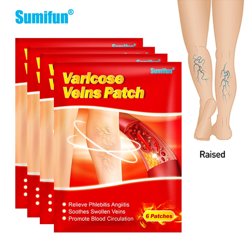 6/18/30pcs Sumifun 100% original Varicose Veins Plaster Vasculitis Phlebitis Spider Leg Medical Patch Angiitis Removal Patch
6/18/30pcs Sumifun 100% original Varicose Veins Plaster Vasculitis Phlebitis Spider Leg Medical Patch Angiitis Removal Patch