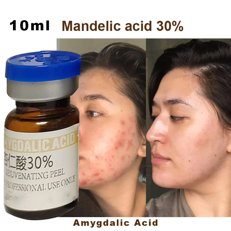 30% Amygdalic Acid Professional Grade Peel AHA Mandelic acid blackhead acne Purify pores exfoliation Skin rejuvenation10ML
30% Amygdalic Acid Professional Grade Peel AHA Mandelic acid blackhead acne Purify pores exfoliation Skin rejuvenation10ML