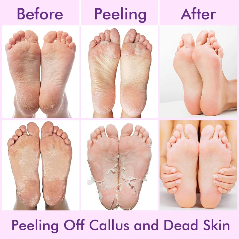 20Pcs=10 packs Feet Peeling Foot Mask Spa Socks Smooth Dead Skin Remover Moisturizing Whitening Feet Scrub Detox Care Foot Mask
20Pcs=10 packs Feet Peeling Foot Mask Spa Socks Smooth Dead Skin Remover Moisturizing Whitening Feet Scrub Detox Care Foot Mask