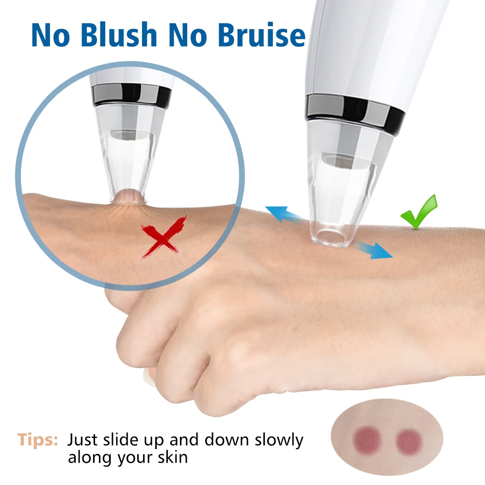 Facial Pore Cleaner Blackhead Remover Vacuum USB Rechargeable Face Skin Care Suction Pimples Black Head Removal Deep Cleansing
Facial Pore Cleaner Blackhead Remover Vacuum USB Rechargeable Face Skin Care Suction Pimples Black Head Removal Deep Cleansing