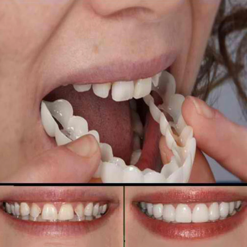 NEW Upper & Lower Teeth Brace Whitening Cover Teeth Veneers Whitening Comfortable
NEW Upper & Lower Teeth Brace Whitening Cover Teeth Veneers Whitening Comfortable
