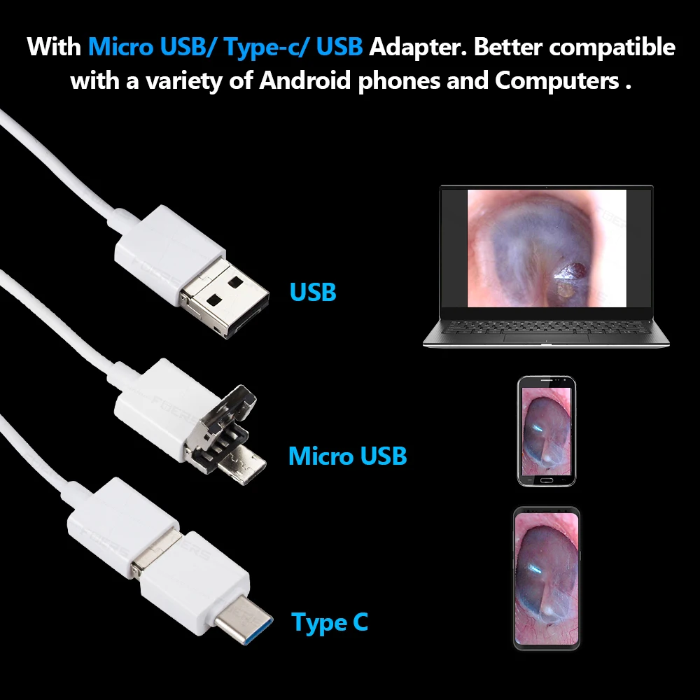 TOWODE Ear Clearing Endoscope 3.9mm Small Lens Household Borescope Camera HD 480P Ear Mouth Nose Otoscope Inspection Endoscope
TOWODE Ear Clearing Endoscope 3.9mm Small Lens Household Borescope Camera HD 480P Ear Mouth Nose Otoscope Inspection Endoscope