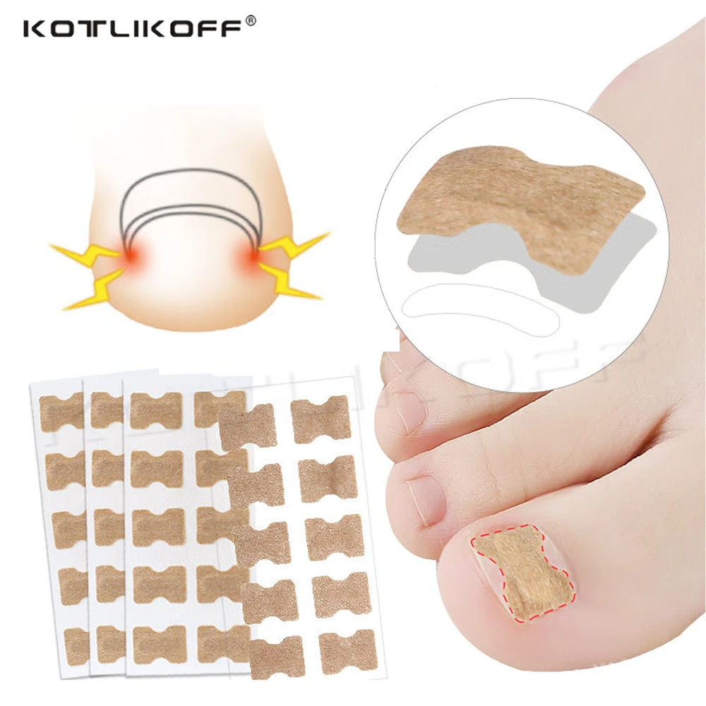 KOTLIKOFF 10PCS Ingrown Toenail Corrector Stickers Paronychia Treatment Recover Corrector Pedicure Tool Fingernail Toe Nail Care
KOTLIKOFF 10PCS Ingrown Toenail Corrector Stickers Paronychia Treatment Recover Corrector Pedicure Tool Fingernail Toe Nail Care