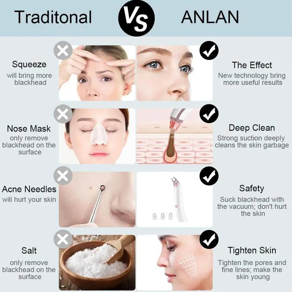 Electric Blackhead Remover Nose Pore Pimple Cleaner Vacuum +2x Sucker Set Face Pore Vacuum Pimple Skin Tag Nose Cleaning 
Electric Blackhead Remover Nose Pore Pimple Cleaner Vacuum +2x Sucker Set Face Pore Vacuum Pimple Skin Tag Nose Cleaning