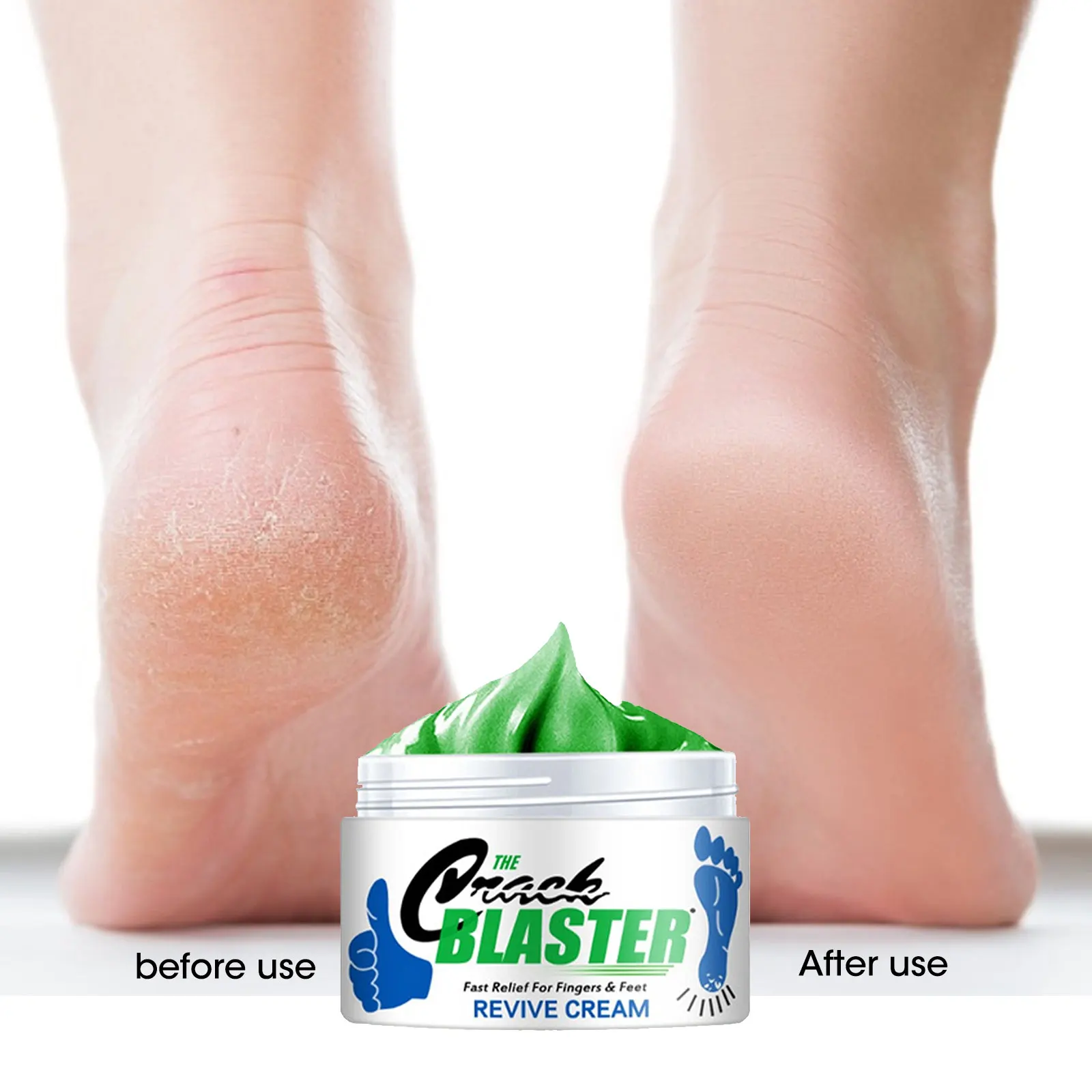 30g Hand Foot Anti-cracking Cream Anti-Drying Crack Foot Cream Heel Cracked Repair Cream Removal Dead Skin Hand Feet Care
30g Hand Foot Anti-cracking Cream Anti-Drying Crack Foot Cream Heel Cracked Repair Cream Removal Dead Skin Hand Feet Care