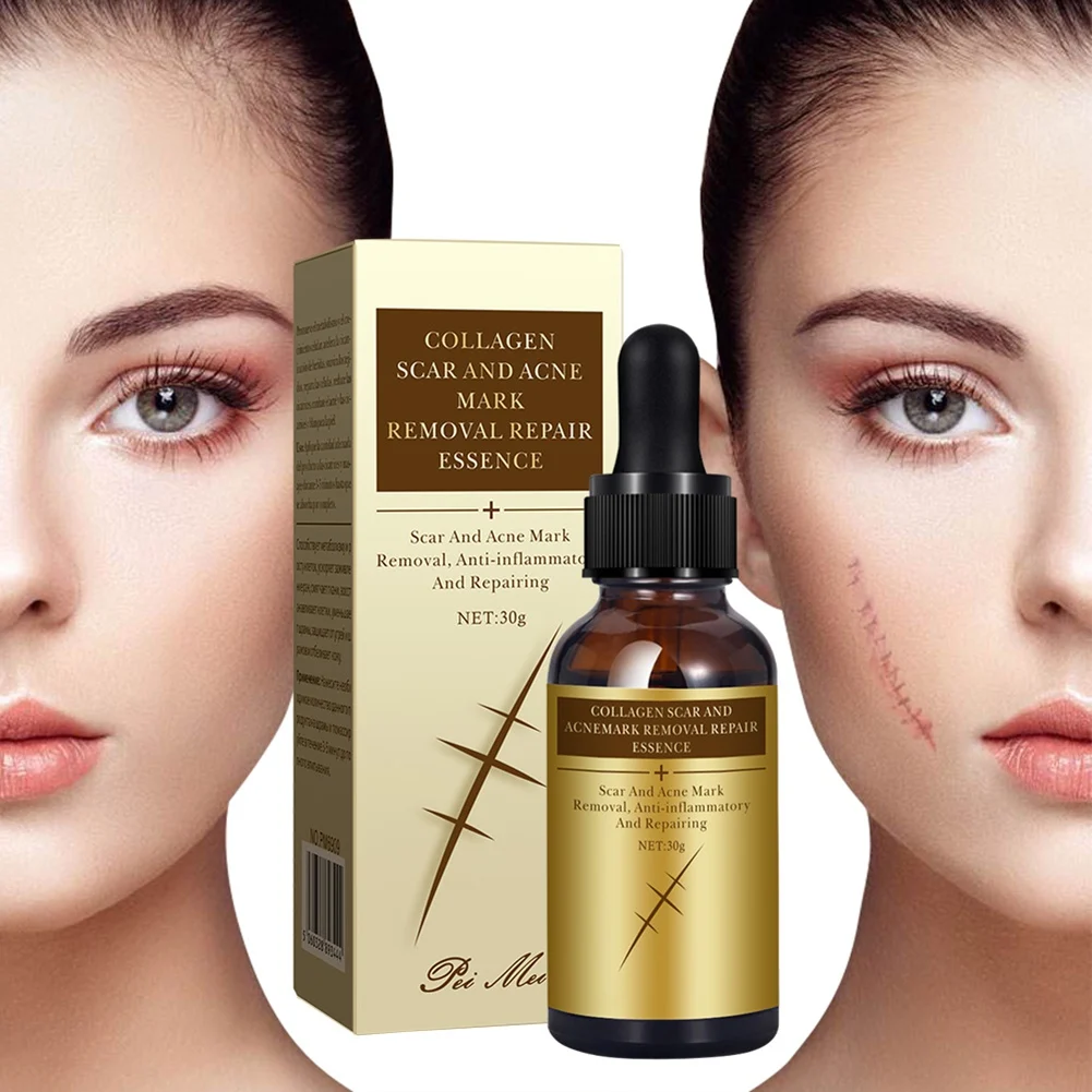 30g Pregnant Women Skin Care Repair Essence Collagen Remove Scar Essence Fade Spot Scar Repair Essence Scar Removal Serum
30g Pregnant Women Skin Care Repair Essence Collagen Remove Scar Essence Fade Spot Scar Repair Essence Scar Removal Serum