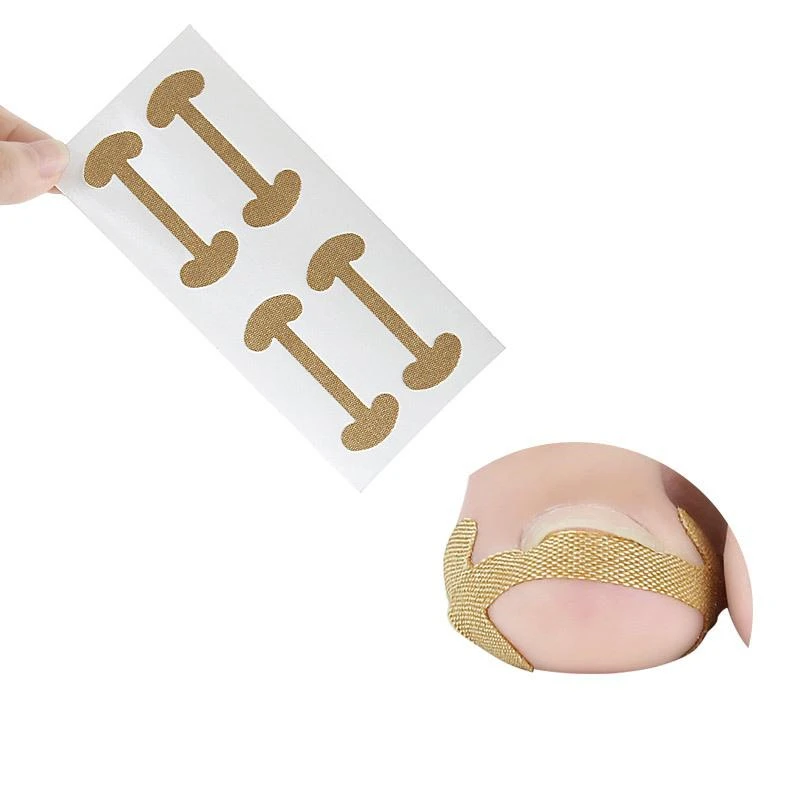 60Pcs Ingrown Toenail Corrector Sticker Fixer Paronychia Recover Toenail Elastic Patch Corrector Pedicure Foot Toe Nail CareTool
60Pcs Ingrown Toenail Corrector Sticker Fixer Paronychia Recover Toenail Elastic Patch Corrector Pedicure Foot Toe Nail CareTool