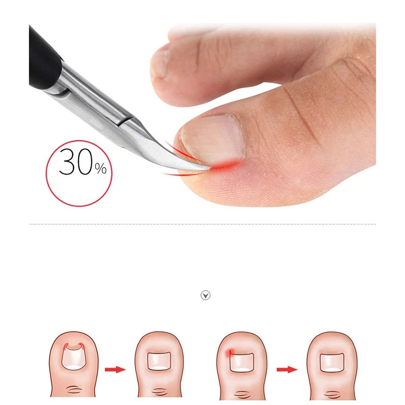 10Pcs Poly Extension Gel Brush & 1set Nippers Stainless Steel Nail Dead Skin Scissors Cuticle Cutters Trimmer
10Pcs Poly Extension Gel Brush & 1set Nippers Stainless Steel Nail Dead Skin Scissors Cuticle Cutters Trimmer
