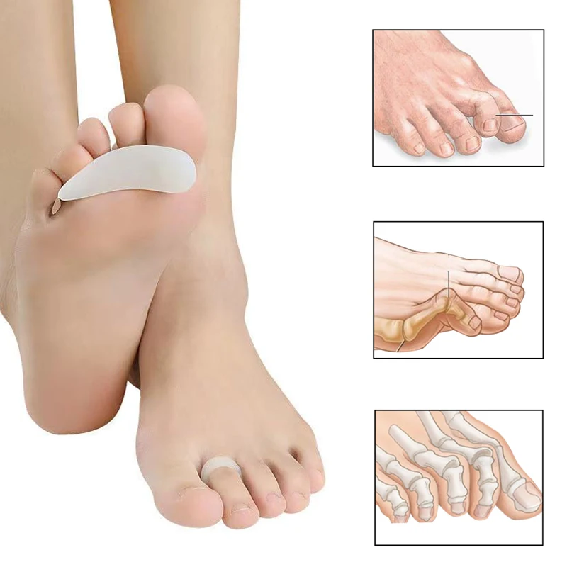 1 Pair Middle Toe Silicone Support Pads For Hammer Toe Correct Separator Metatarsal Ring Orthopedic Straightener Foot Care Tool
1 Pair Middle Toe Silicone Support Pads For Hammer Toe Correct Separator Metatarsal Ring Orthopedic Straightener Foot Care Tool
