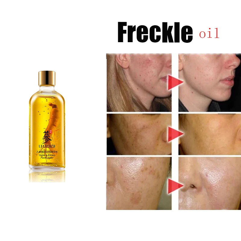 Ginseng Essence Freckle Removing 100ML Water Firming Moisturizing Repairing Anti-Aging Brighten Whitening Serums Remove Melasma
Ginseng Essence Freckle Removing 100ML Water Firming Moisturizing Repairing Anti-Aging Brighten Whitening Serums Remove Melasma