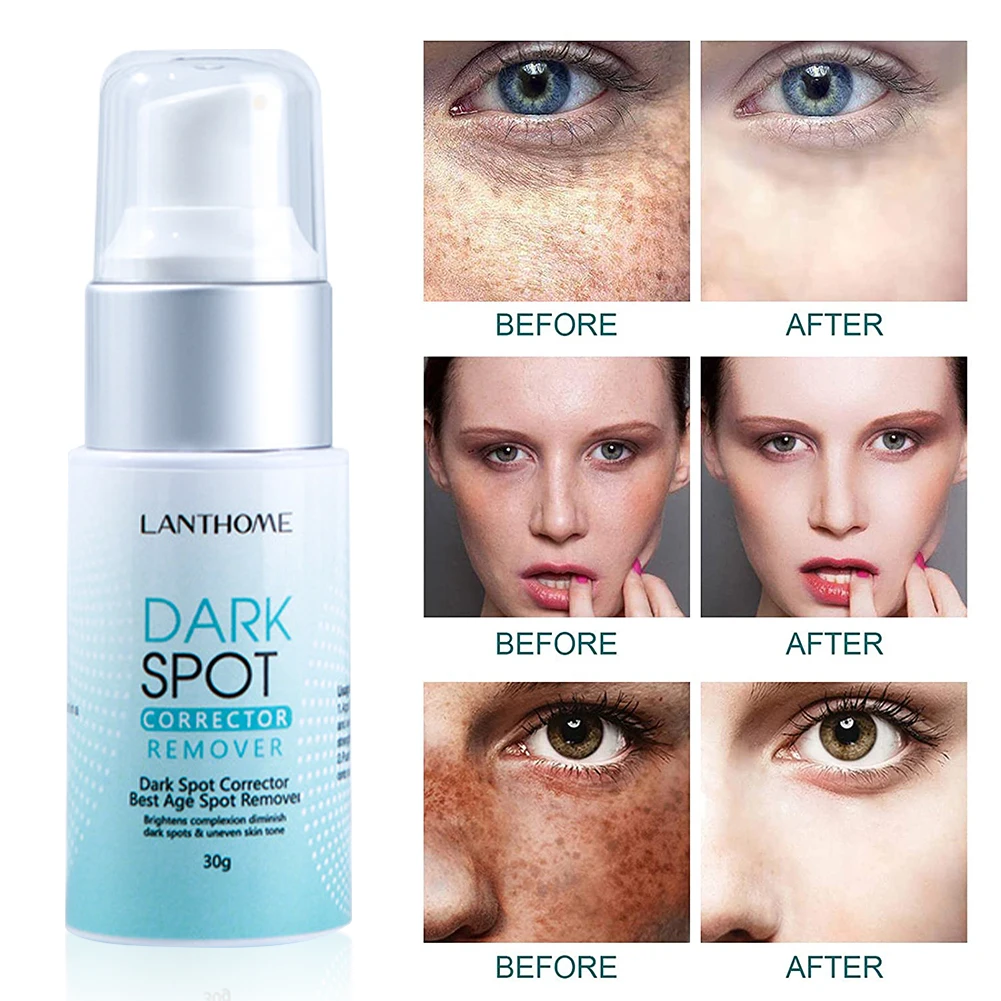 Lanthome Dark Spot Remover Corrector Age Spot Freckle Removal Emulsion Whitening Moisturizing Anti-Aging Skin Repair Skin Care
Lanthome Dark Spot Remover Corrector Age Spot Freckle Removal Emulsion Whitening Moisturizing Anti-Aging Skin Repair Skin Care