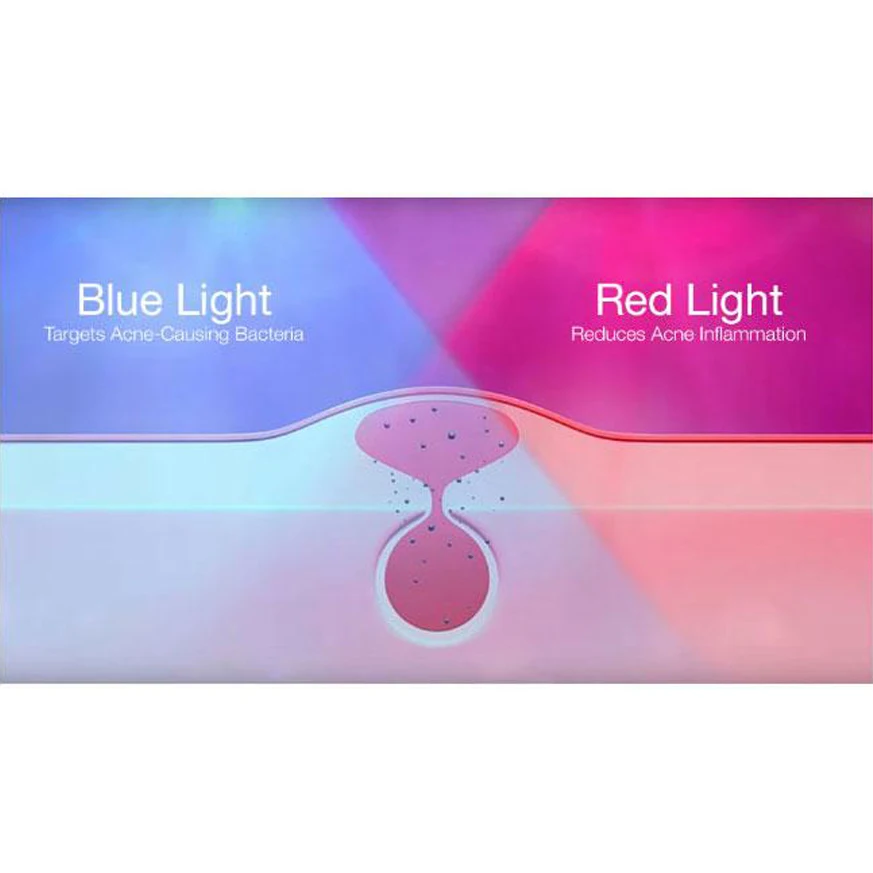 New Arrival Medical Red Light Therapy Treatment Laser Pen Soft Scar Wrinkle Removal Treatme acne light therapy
New Arrival Medical Red Light Therapy Treatment Laser Pen Soft Scar Wrinkle Removal Treatme acne light therapy