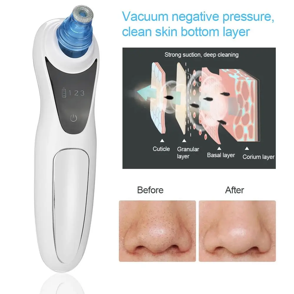 Newest USB Electric Blackhead Acne Hand-Held Facial Cleansing Fades Fines lines Increase Skin Elasticity Beauty Care Instruments
Newest USB Electric Blackhead Acne Hand-Held Facial Cleansing Fades Fines lines Increase Skin Elasticity Beauty Care Instruments