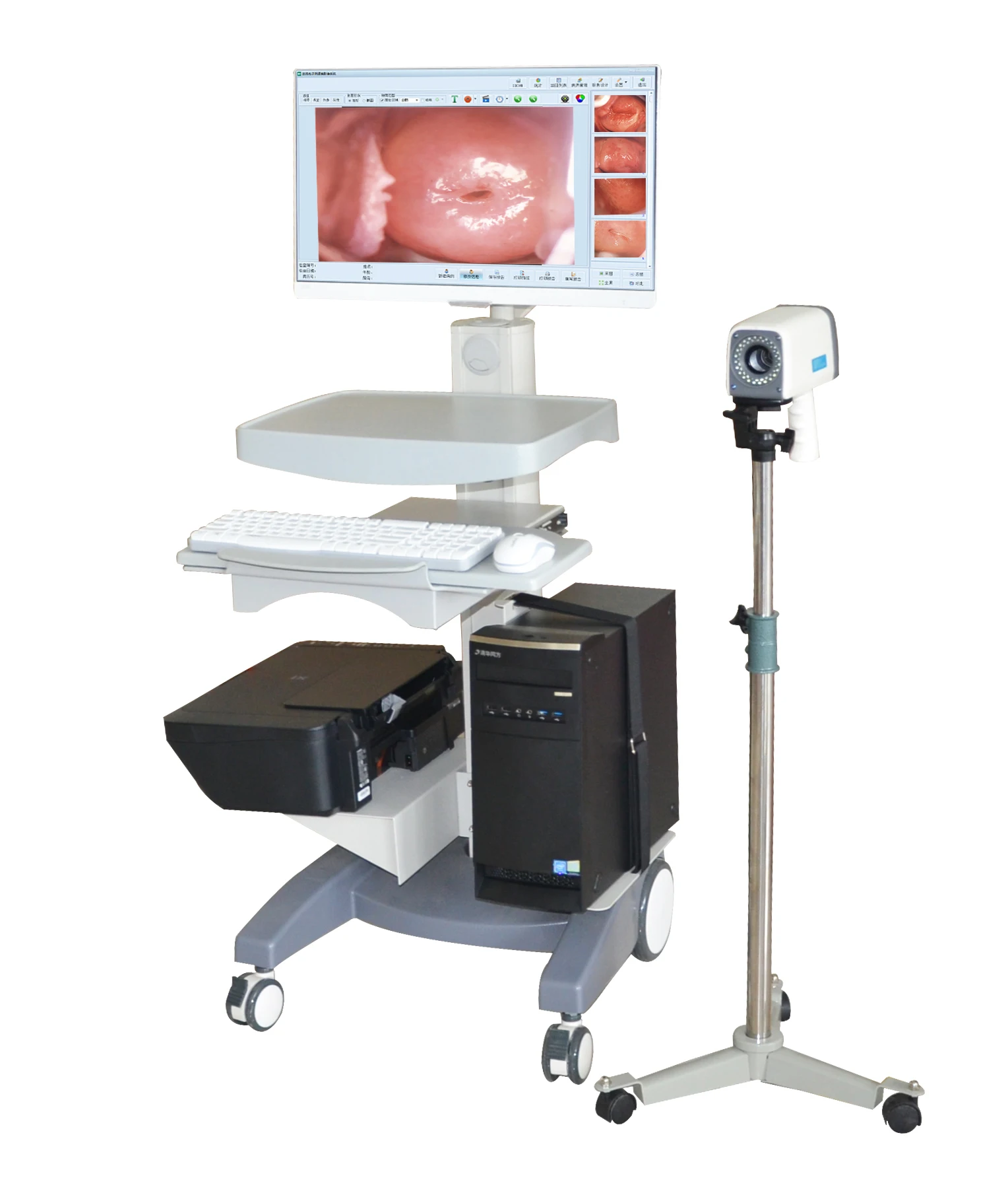 Цифровое видео-кольпоскоп HD для гинекологии, система визуализации Colposcopy, датчик изображения CCD
Цифровое видео-кольпоскоп HD для гинекологии, система визуализации Colposcopy, датчик изображения CCD