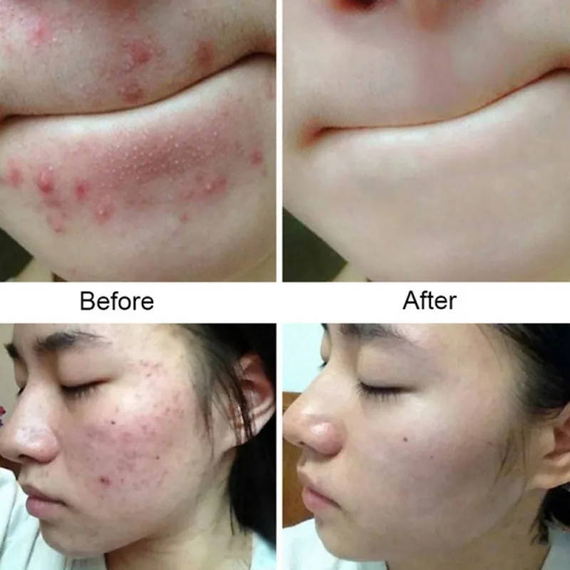 Sea Salt Soap Cleaning Skin Anti-mite Oil-control Firming Handmade For Body Face
Sea Salt Soap Cleaning Skin Anti-mite Oil-control Firming Handmade For Body Face