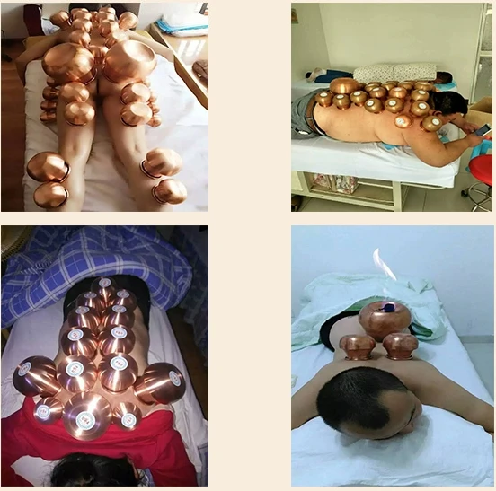 9 Банок/набор китайские медицинские массажеры для тела | Красота и здоровье