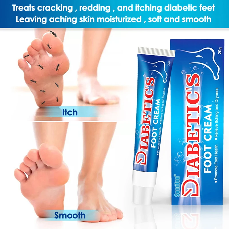 20g Diabetic Cream For Foot Care Herbal Ointment Relieve Toe Fungus Anti Fungal Infection Eczema Urticaria Beriberi Foot Care
20g Diabetic Cream For Foot Care Herbal Ointment Relieve Toe Fungus Anti Fungal Infection Eczema Urticaria Beriberi Foot Care