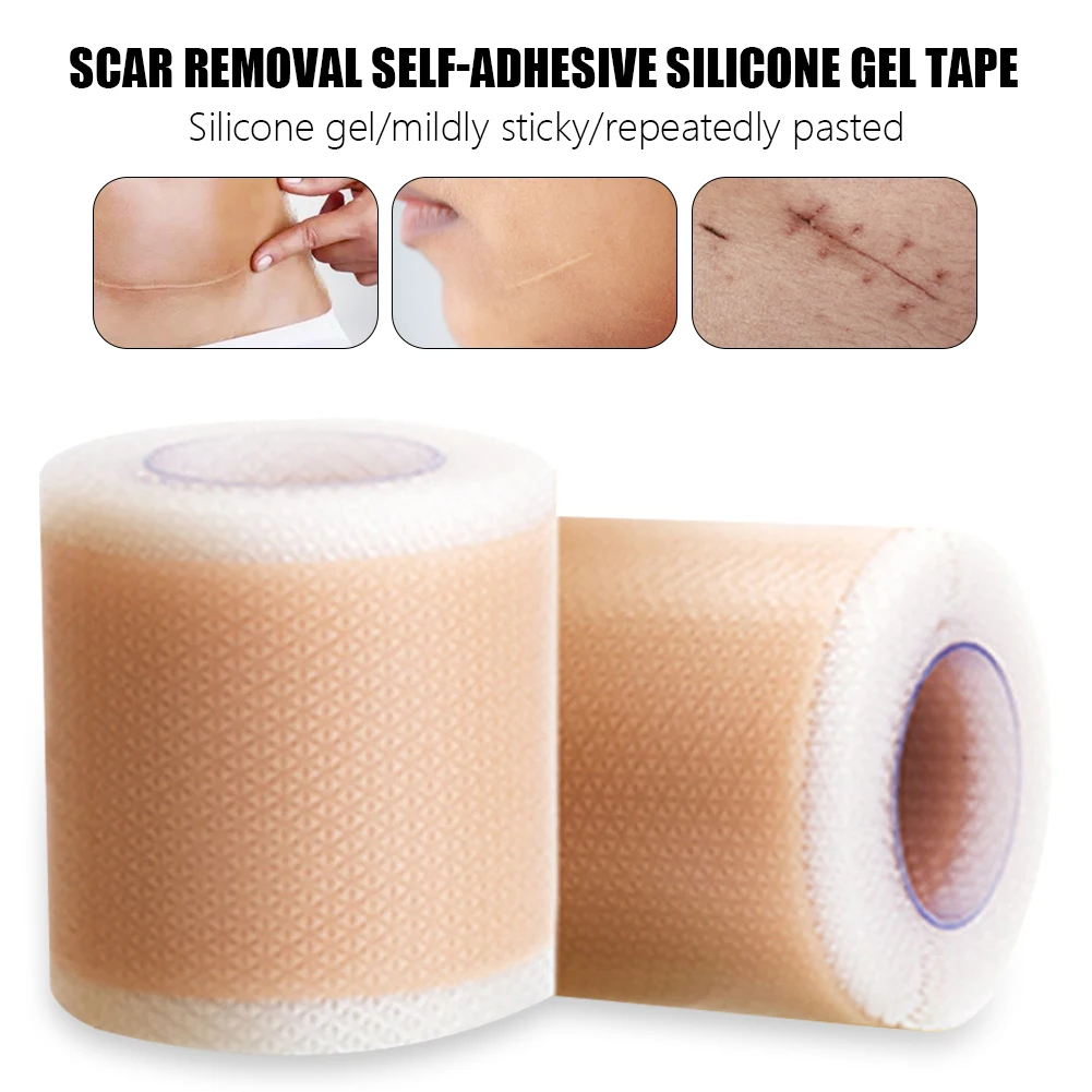 

4x50cm Silicone Scars Patch Wounds Band Remove Acne Burn Scar Treatment Cover Ear Correctors Efficient Repair Damaged Skin Sheet