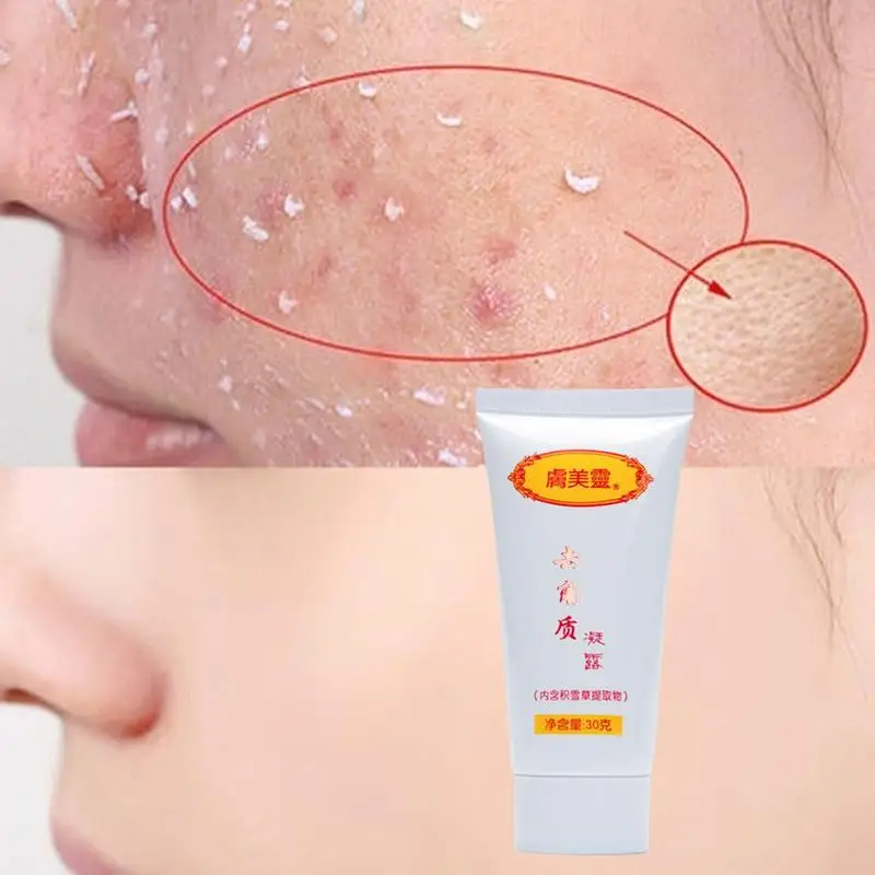 Ginger Exfoliating Gel Scrubs Hyaluronic Acid Cleanser Nourishing Cleanser Moisturizing Face Wash Anti-spot Gel
Ginger Exfoliating Gel Scrubs Hyaluronic Acid Cleanser Nourishing Cleanser Moisturizing Face Wash Anti-spot Gel