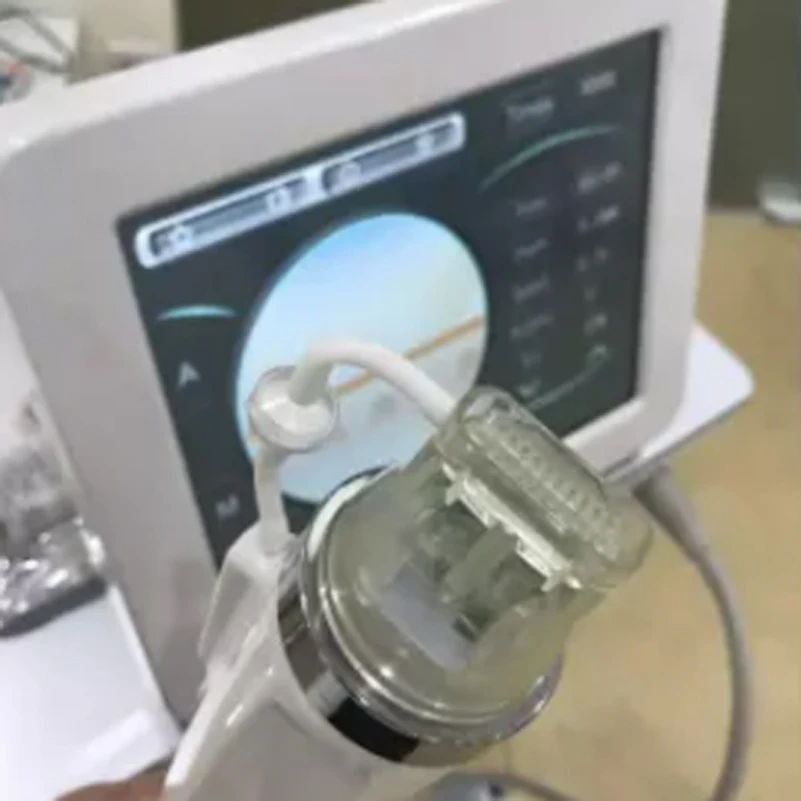 RF Fractional micro-needle beauty machine anti-acne skin lifting anti-wrinkle spa equipment
RF Fractional micro-needle beauty machine anti-acne skin lifting anti-wrinkle spa equipment