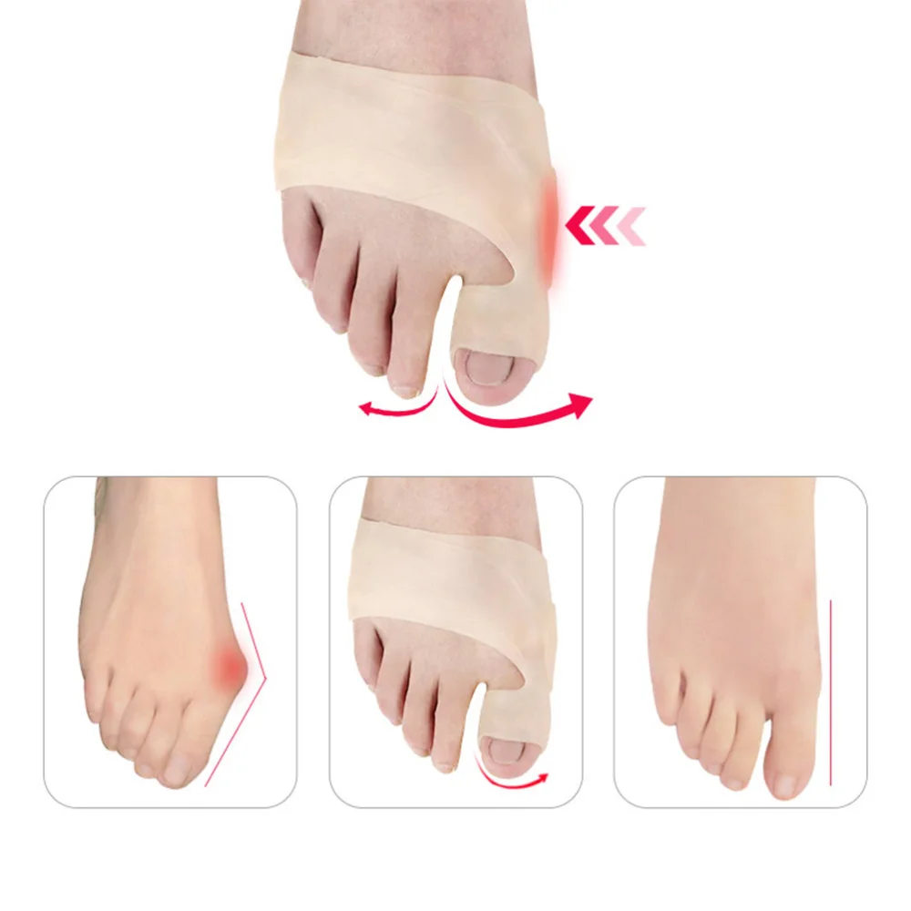 2 Pairs/1 Set Foot Thumb Valgus Toe Correctors Toe Straightener Toe Orthotic Separator Foot Care Supplies (White/Skin Color)
2 Pairs/1 Set Foot Thumb Valgus Toe Correctors Toe Straightener Toe Orthotic Separator Foot Care Supplies (White/Skin Color)