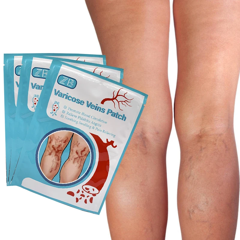 6/12Pcs Varicose Veins Patch Vasculitis Phlebitis Spider Cream Varicosity Angiitis Removal Herbal Medical Plaster 
6/12Pcs Varicose Veins Patch Vasculitis Phlebitis Spider Cream Varicosity Angiitis Removal Herbal Medical Plaster