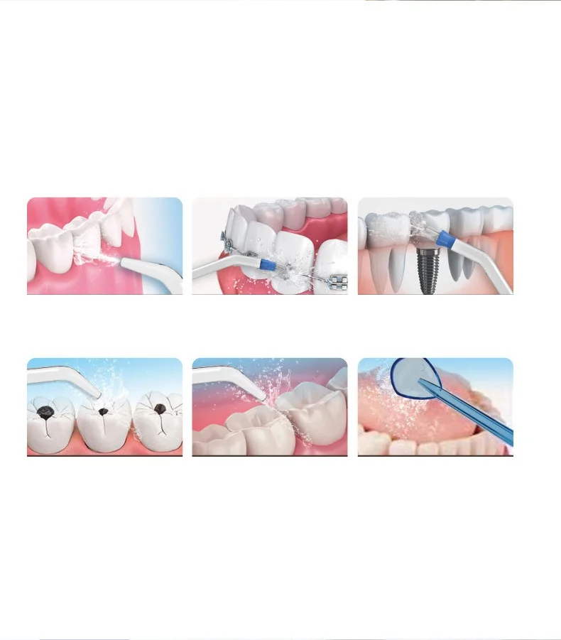 100-240V Dental Flosser Professional Oral Irrigation 800ml Oral Hygiene Water Floss For Family Daily Oral Care
100-240V Dental Flosser Professional Oral Irrigation 800ml Oral Hygiene Water Floss For Family Daily Oral Care