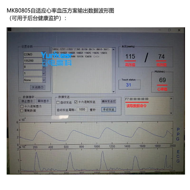 MKB0805 Dynamic heart rate blood pressure regimen PPG Heart Rate module Pulse and blood pressure sensor module
MKB0805 Dynamic heart rate blood pressure regimen PPG Heart Rate module Pulse and blood pressure sensor module
