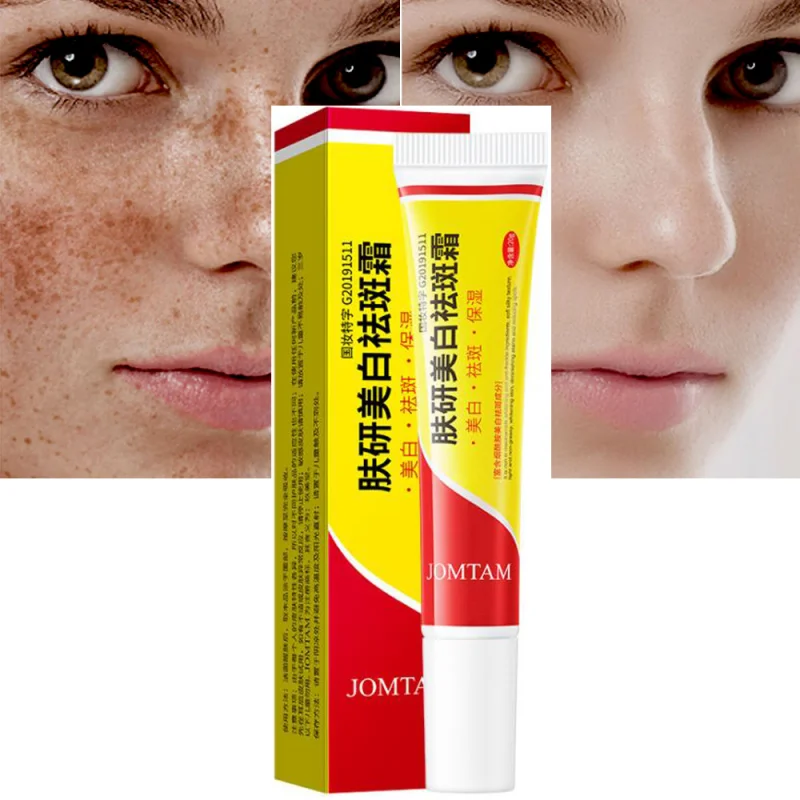 Effective Whitening Freckle Cream Remove Melasma Acne Spot Pigment Melanin Dark Spots Pigmentation Moisturizing Gel Skin Care
Effective Whitening Freckle Cream Remove Melasma Acne Spot Pigment Melanin Dark Spots Pigmentation Moisturizing Gel Skin Care
