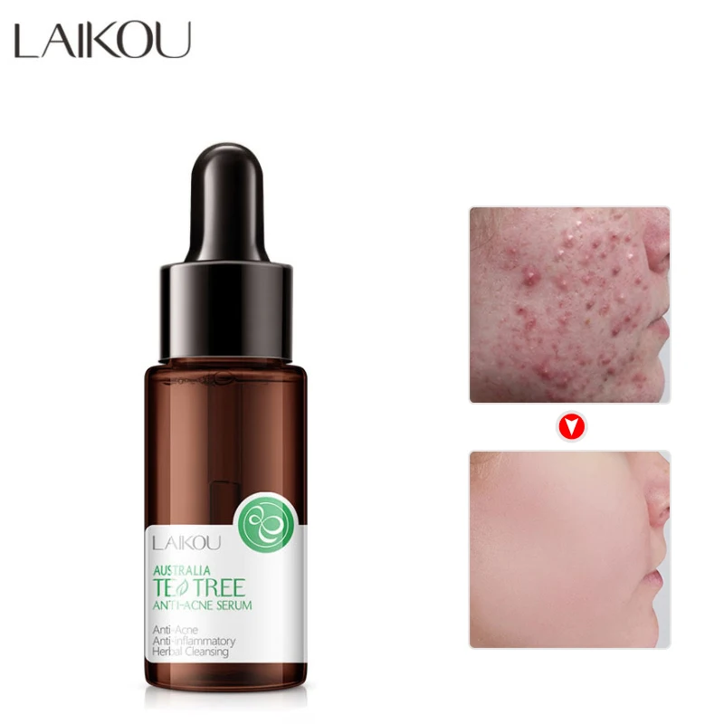 Tea Tree Acne Treatment Serum Face Care Shrink Pores Oil Control Moisturizing Anti-Inflammatory Whiten Nourish Korean Cosmetics
Tea Tree Acne Treatment Serum Face Care Shrink Pores Oil Control Moisturizing Anti-Inflammatory Whiten Nourish Korean Cosmetics