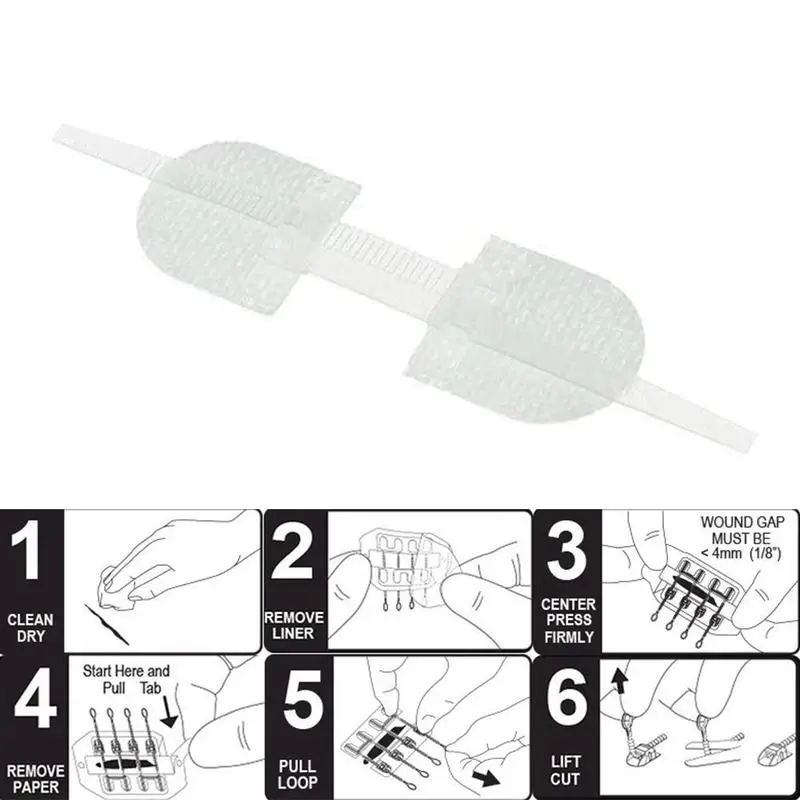 3 Pieces/Set of Zipper Tie Wound Closure Patch Hemostatic Patch Wound Suture Zipper Band-Aid Outdoor Portable Fast A1D1
3 Pieces/Set of Zipper Tie Wound Closure Patch Hemostatic Patch Wound Suture Zipper Band-Aid Outdoor Portable Fast A1D1