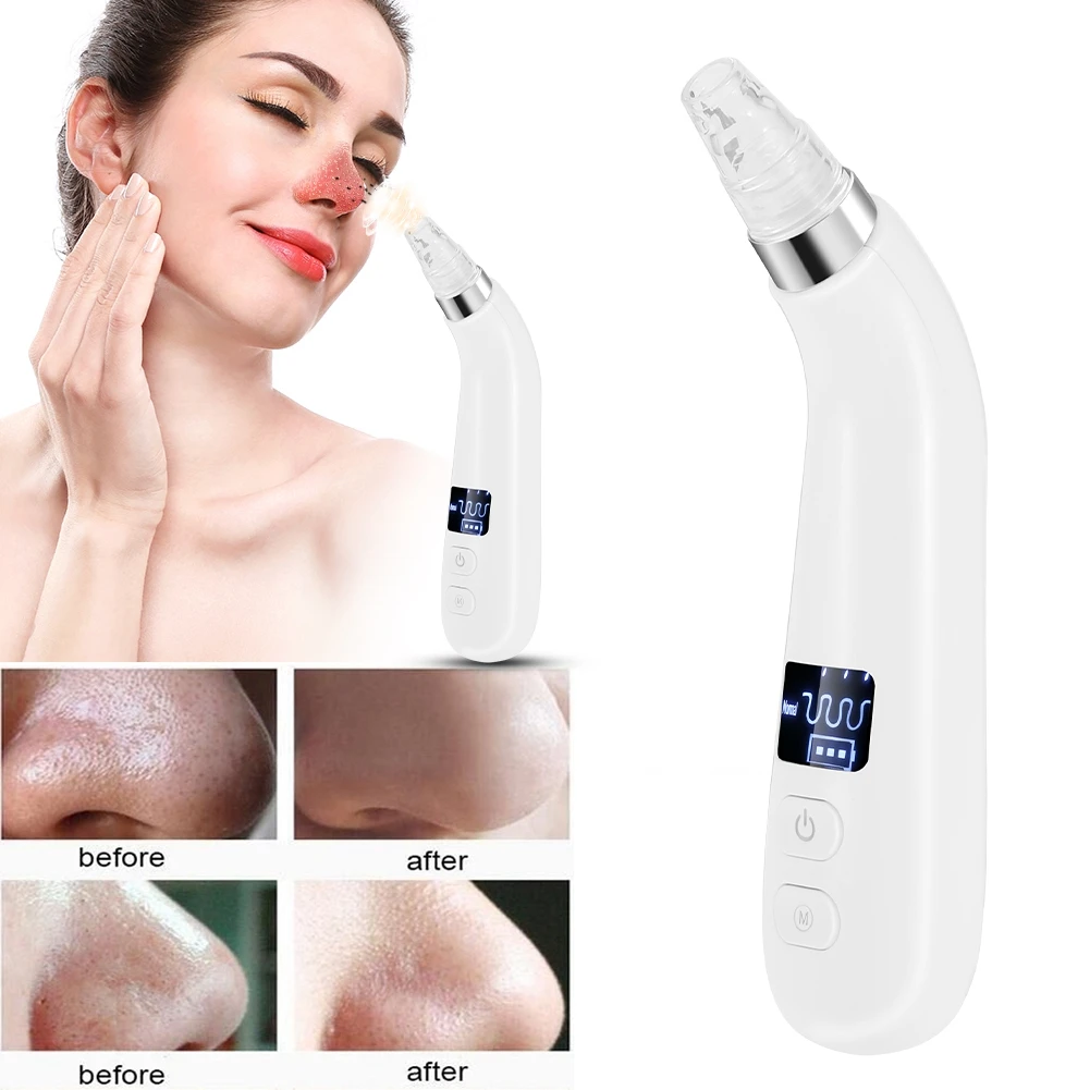 New Upgrade Blackhead Absorbing Artifact Adjustable Suction Importing Instrument Led Display Blackhead Acne Absorbing Cleaner
New Upgrade Blackhead Absorbing Artifact Adjustable Suction Importing Instrument Led Display Blackhead Acne Absorbing Cleaner