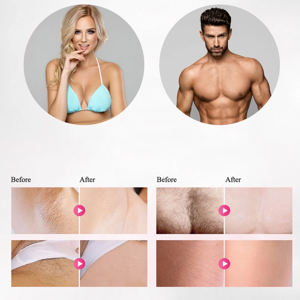 DEARKYLIE 600000 Flash ipl laser hair removal machine depilador a laser epilasyon depiladora depilator laserowy epilator
DEARKYLIE 600000 Flash ipl laser hair removal machine depilador a laser epilasyon depiladora depilator laserowy epilator